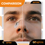 Agilmix Refill Magnetic Breathing Nasal Strips - 30, 60, 90-Days Supply for Enhanced Breathing - Compatible with Recharging, Nude & Transparent Color