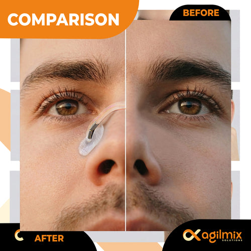 Agilmix Refill Magnetic Breathing Nasal Strips - 30, 60, 90-Days Supply for Enhanced Breathing - Compatible with Recharging, Nude & Transparent Color