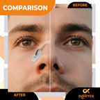 Agilmix Refill Magnetic Breathing Nasal Strips - 30, 60, 90-Days Supply for Enhanced Breathing - Compatible with Recharging, Nude & Transparent Color